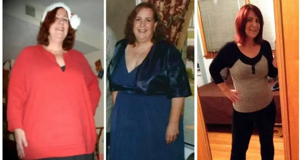 One woman lost 260 pounds in 9 months